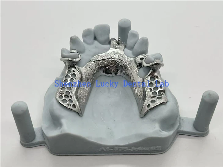Cast Framework Delproteser