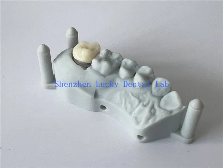 Kina 3D Print Dental All Ceramic Zirconia Crown Factory